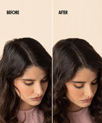Dry Shampoo